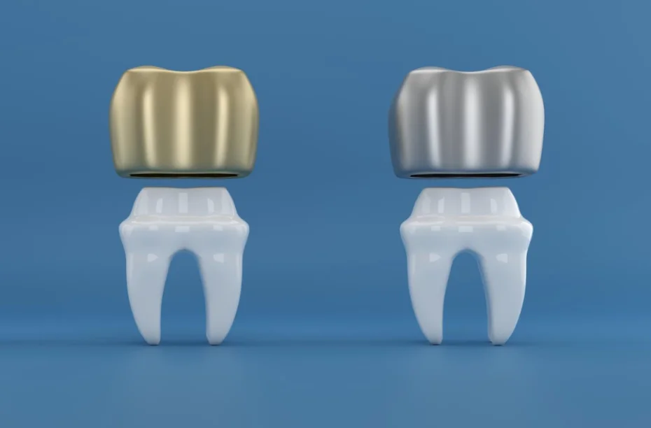 Dental Crowns Explained: Are They the Right Fit for Your Damaged Tooth?